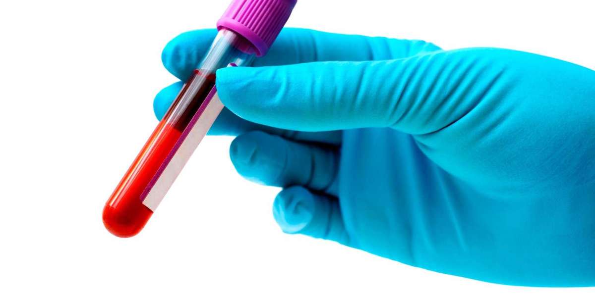 Blood tests understanding your pet's blood work Vetwest Veterinary Clinics